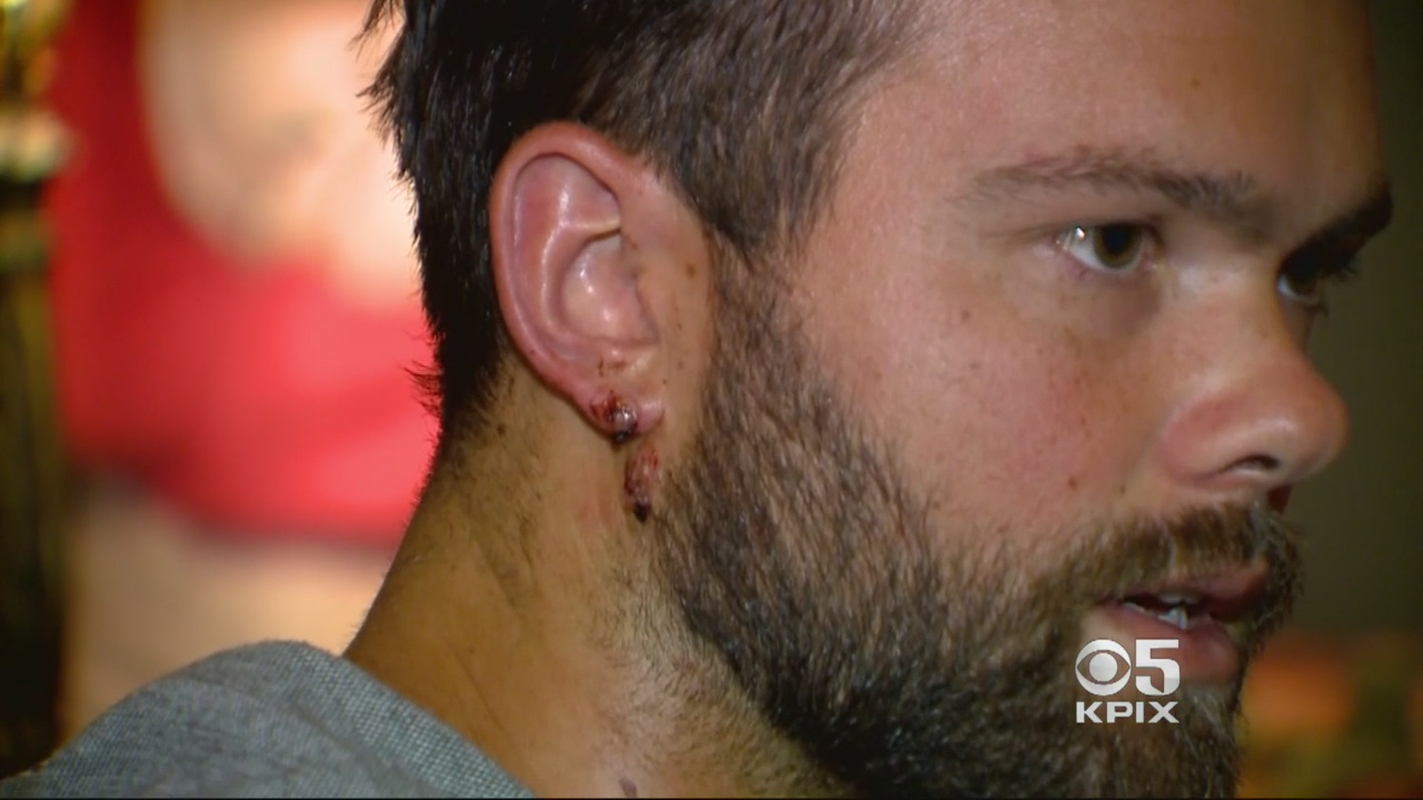 Jeff Christerson survived being shot in the neck during the October 1, 2017 massacre in Las Vegas. (CBS)
